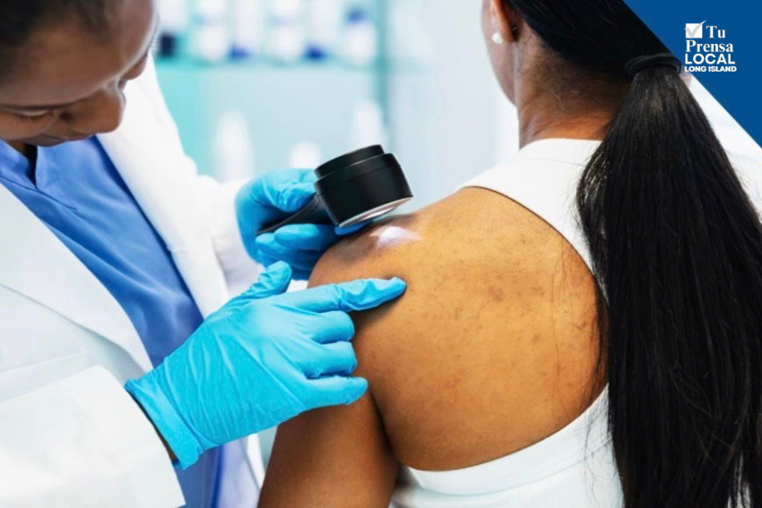 Ministerio Rural y de Migrantes ofrecerá pruebas gratuitas de detección de cáncer de piel para personas sin seguro en Riverhead